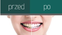 Przed i po